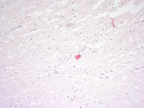 Brain tissue microscopic image Stock Photos