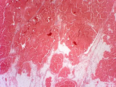 Brain tissue microscopic image Stock Photos