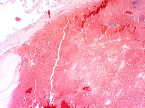 Brain tissue microscopic image Stock Photos