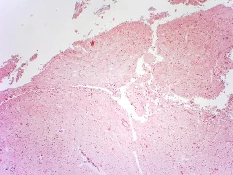 Brain tissue microscopic image Stock Photos