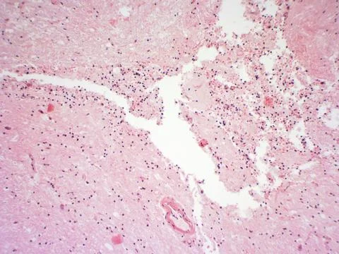 Brain tissue microscopic image Stock Photos