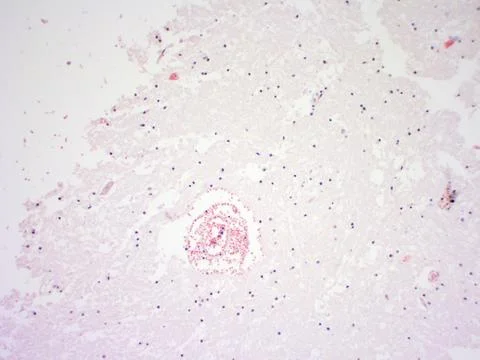 Brain tissue microscopic image Stock Photos