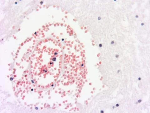 Brain tissue microscopic image Stock Photos