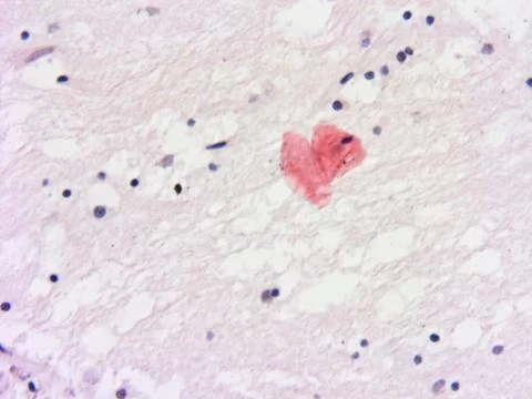 Brain tissue microscopic image Stock Photos