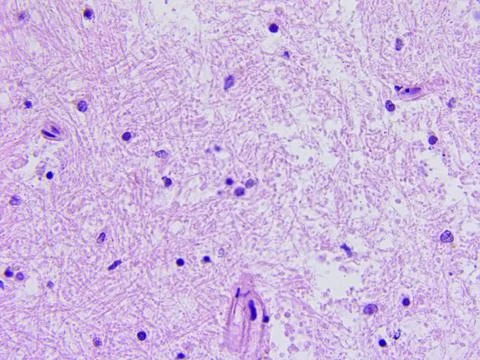 Brain tissue microscopic photography Stock Photos