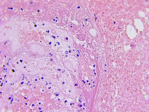 Brain tissue microscopic photography Stock Photos