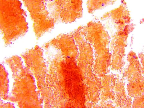 Brain tissue microscopic photography Stock Photos