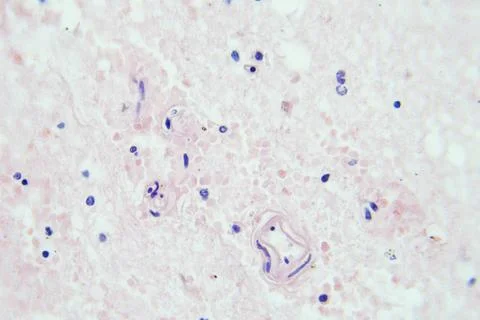 Brain tissue microscopic view magnification x400 Stock Photos