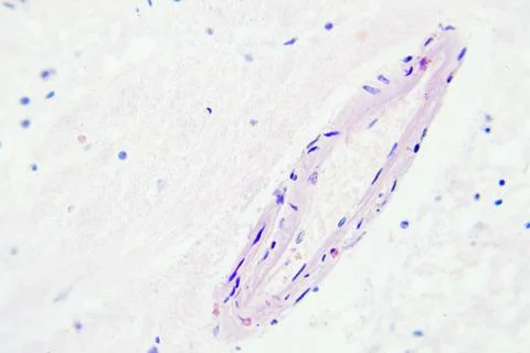 Brain tissue microscopic view magnification x400 Stock Photos