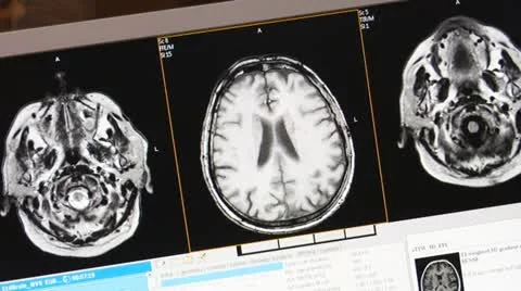 Brain tomogram Stock Footage 12140181