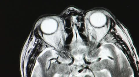 Brain tomogram Stock Footage 12140227