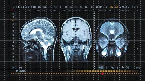 Brain Tomography On Mri Scan Professional Medical Equipment. Stock Illustration