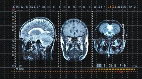 Brain Tomography On Mri Scan Professional Medical Equipment. Stock Illustration