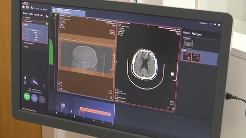 Brain tomography scan Stock Footage 104651613