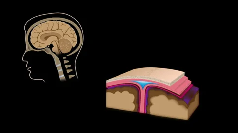 Brain trauma with axon shear Stock Footage 28501476