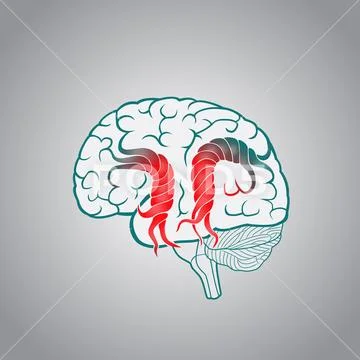 Brain with the twisted convolutions, of the destruction of brain, stroke, memory Stock Illustration