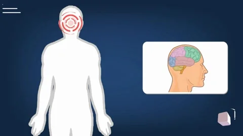 Brain - vector animation - analysis - blue Stock Footage 60398152