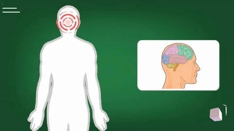 Brain - vector animation - analysis - green Stock Footage 60398168