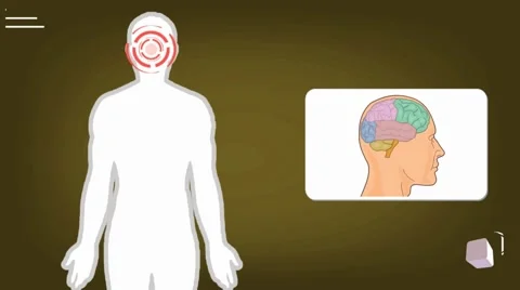 Brain - vector animation - analysis - orange Stock Footage 60398192