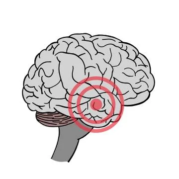 Brain in vector. Headache. Place of pain in brain. Stock Illustration