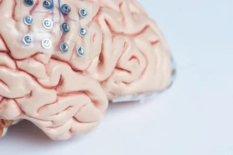 Brain waves recording electrodes on brain model surface Stock Photos