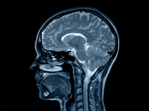 Brain x-ray ct head vertebrae spine cord incision Stock Photos