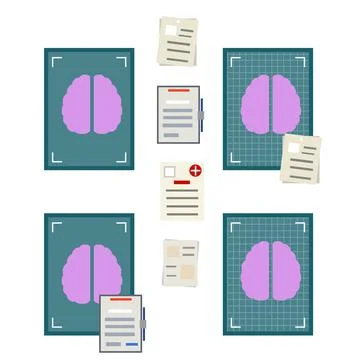 Brain x-ray. Tomography of head. Medical care. Cartoon flat illustration Stock Illustration