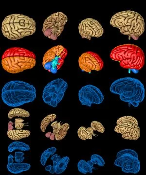 Brain with xray style image and colored zones isolated  - creative Illustrazione stock
