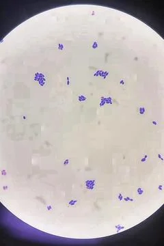Branching budding yeast cells in gram stain fine with microscope. Stock Photos