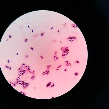 Branching budding yeast cells with pseudohyphae in gram stain. Stock Photos
