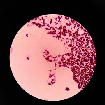 Branching budding yeast cells with pseudohyphae in gram stain. Stock Photos