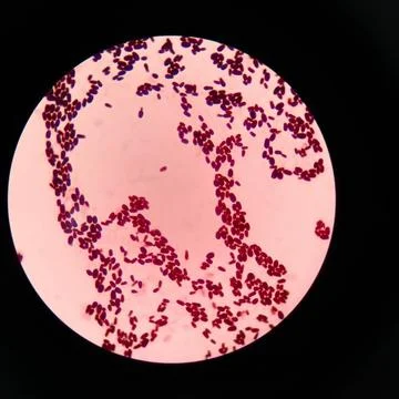 Branching budding yeast cells with pseudohyphae in gram stain. Stock Photos