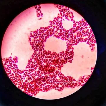 Branching budding yeast cells with pseudohyphae in gram stain. Stock Photos