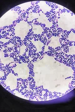 Branching budding yeast cells with pseudohyphae in gram stain Stock Photos