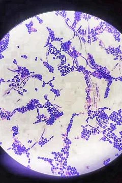 Branching budding yeast cells with pseudohyphae in gram stain Stock Photos