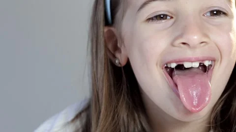 A little girl show tongue throat. portra, Stock Video