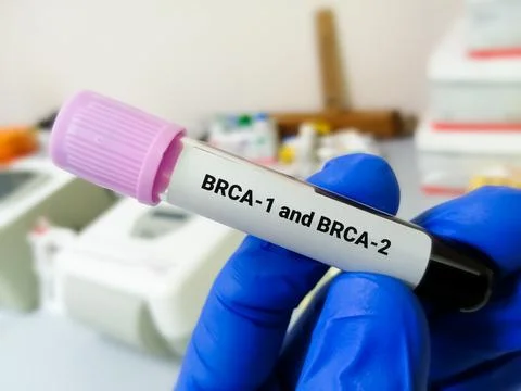 BRCA1 and BRCA2 are two genes that are important to fighting cancer Foto stock