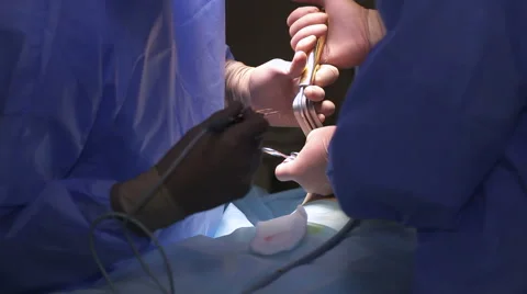 Breast augmentation surgery 動画素材 61093949