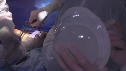Breast augmentation surgery in the operating room surgeon tools implant. Stock Footage 105183814