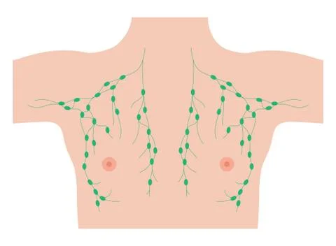 Breast disease concept Stock Illustration