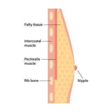 Breast disease concept Stock Illustration