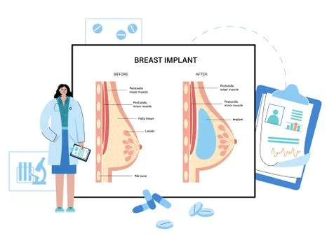 Breast disease concept Illustrazione stock