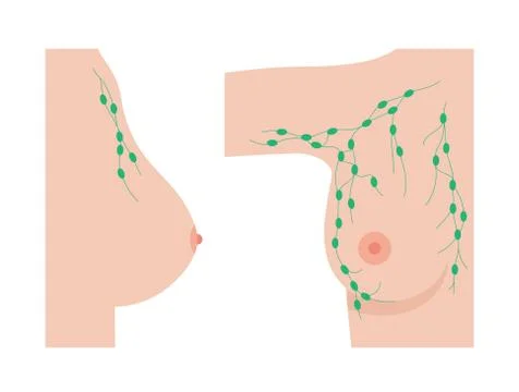 Breast disease concept Stock Illustration