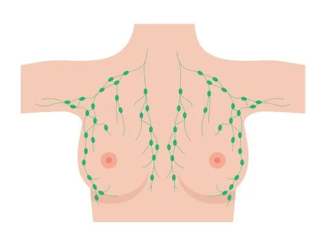 Breast disease concept Stock Illustration