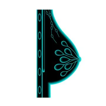 Breast disease concept Stock Illustration