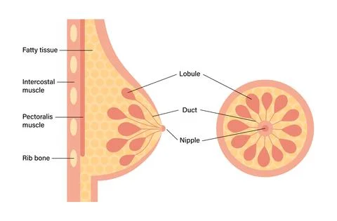 Breast disease concept Illustrazione stock