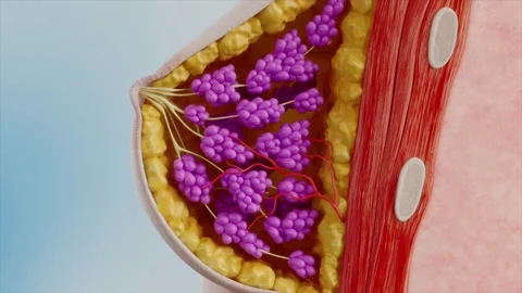 Breast hyperplasia causes abnormal enlargement Stockbeeldmateriaal 345016215