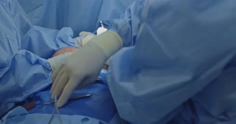 Breast implant replacement. Plastic surgery 動画素材 204025645