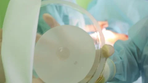 Breast implant before surgery 스톡 동영상 64682394