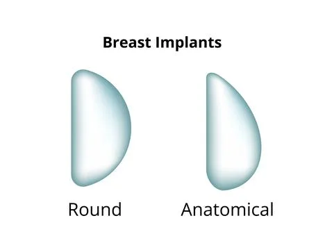Breast implants comparing round and anatomical shapes Stock Illustration
